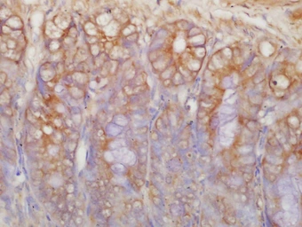 Anti-c-Kit antibody used in IHC (Paraffin sections) (IHC-P). GTX33947