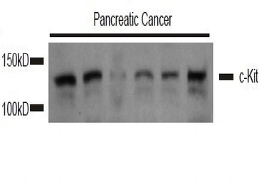 Anti-c-Kit antibody used in Western Blot (WB). GTX33947