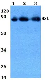 Anti-HSL antibody used in Western Blot (WB). GTX33956