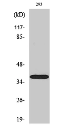 Anti-HSD17B11 antibody used in Western Blot (WB). GTX33994