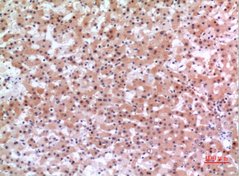 Anti-Inhibin beta E chain antibody used in IHC (Paraffin sections) (IHC-P). GTX34017
