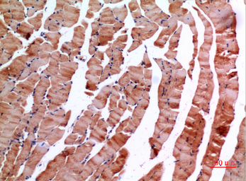 Anti-Inhibin beta E chain antibody used in IHC (Paraffin sections) (IHC-P). GTX34017