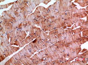 Anti-Inhibin beta E chain antibody used in IHC (Paraffin sections) (IHC-P). GTX34017
