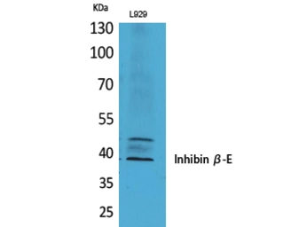 Anti-Inhibin beta E chain antibody used in Western Blot (WB). GTX34017