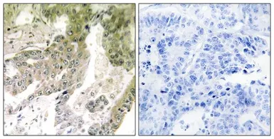 Anti-Laminin alpha 5 antibody used in IHC (Paraffin sections) (IHC-P). GTX34029