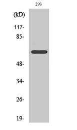 Anti-ARMCX2 antibody used in Western Blot (WB). GTX34038