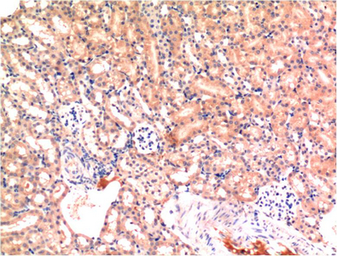 Anti-Bax antibody [6F11] used in IHC (Paraffin sections) (IHC-P). GTX34052