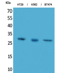 Anti-BRMS1 antibody used in Western Blot (WB). GTX34064