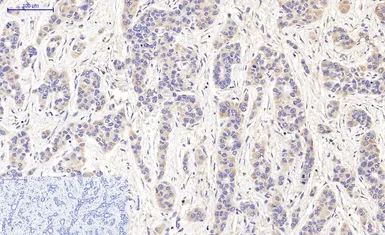 Anti-LC3A antibody [5G10] used in IHC (Paraffin sections) (IHC-P). GTX34067