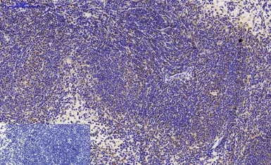 Anti-LC3A antibody [5G10] used in IHC (Paraffin sections) (IHC-P). GTX34067