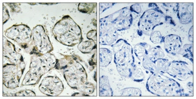 Anti-MT-ND1 antibody used in IHC (Paraffin sections) (IHC-P). GTX34092