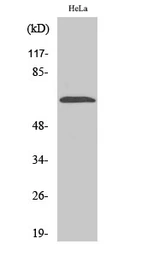 Anti-NEI3 antibody used in Western Blot (WB). GTX34095