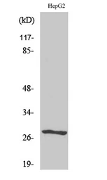 Anti-NPDC1 antibody used in Western Blot (WB). GTX34101