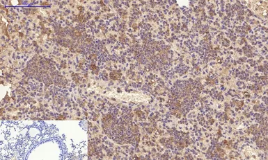 Anti-PDGF Receptor alpha antibody [7A3] used in IHC (Paraffin sections) (IHC-P). GTX34117