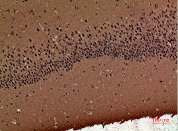 Anti-POLR3G antibody used in IHC (Paraffin sections) (IHC-P). GTX34131