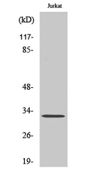 Anti-CCNB1IP1 antibody used in Western Blot (WB). GTX34190