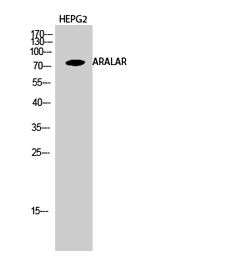 Anti-ARALAR antibody used in IHC (Paraffin sections) (IHC-P). GTX34202