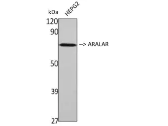 Anti-ARALAR antibody used in Western Blot (WB). GTX34202