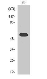 Anti-TOR1AIP1 antibody used in Western Blot (WB). GTX34278