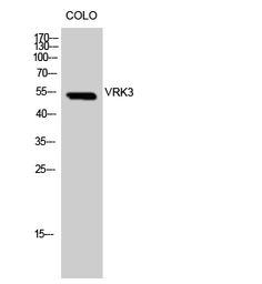 Anti-VRK3 antibody used in Western Blot (WB). GTX34294