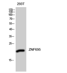 Anti-ZNF695 antibody used in Western Blot (WB). GTX34312