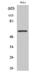Anti-CYP2U1 antibody used in Western Blot (WB). GTX34346