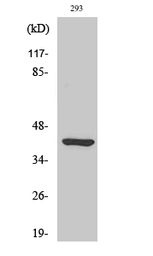 Anti-ETNK2 antibody used in Western Blot (WB). GTX34369