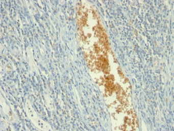 Anti-AMPD3 antibody [AMPD3/901] used in IHC (Paraffin sections) (IHC-P). GTX34411