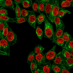 Anti-beta 2 Microglobulin antibody [B2M/961] used in Immunocytochemistry/ Immunofluorescence (ICC/IF). GTX34437