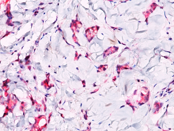 Anti-beta Catenin antibody used in IHC (Paraffin sections) (IHC-P). GTX34438