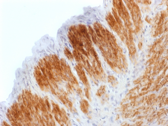 Anti-Calponin 1 antibody [CNN1/1408R] used in IHC (Paraffin sections) (IHC-P). GTX34450
