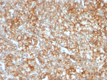Anti-CD147 antibody [BSG/963] used in IHC (Paraffin sections) (IHC-P). GTX34463