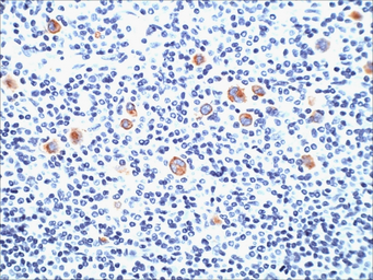 Anti-SSEA-1 / CD15 antibody [SPM490] used in IHC (Paraffin sections) (IHC-P). GTX34465