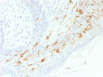 Anti-CD1a antibody [C1A/1506R] used in IHC (Paraffin sections) (IHC-P). GTX34472