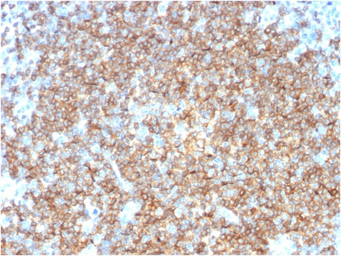 Anti-CD22 antibody [BLCAM/1795] used in IHC (Paraffin sections) (IHC-P). GTX34478