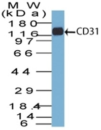 Anti-CD31 antibody [C31.7] used in Western Blot (WB). GTX34489