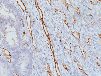 Anti-CD31 antibody [JC70A] used in IHC (Paraffin sections) (IHC-P). GTX34495