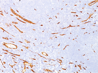 Anti-CD34 antibody [QBEnd/10] used in IHC (Paraffin sections) (IHC-P). GTX34497