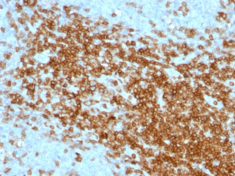 Anti-CD43 antibody [SPN/1094] used in IHC (Paraffin sections) (IHC-P). GTX34511