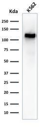 Anti-CD43 antibody [SPN/1094] used in Western Blot (WB). GTX34511