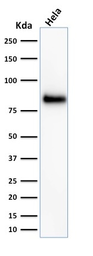 Anti-CD44 antibody [156-3C11] used in Western Blot (WB). GTX34519