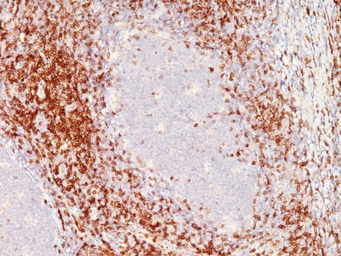 Anti-CD6 antibody [SPM547] used in IHC (Paraffin sections) (IHC-P). GTX34537