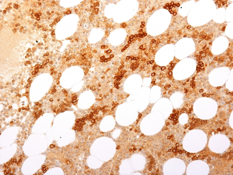 Anti-CD71 antibody [TFRC/1817] used in IHC (Paraffin sections) (IHC-P). GTX34549