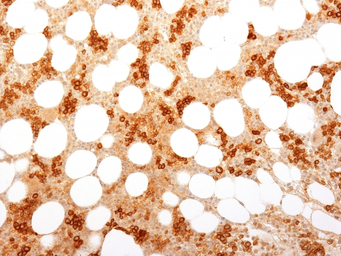 Anti-CD71 antibody [TFRC/1818] used in IHC (Paraffin sections) (IHC-P). GTX34550