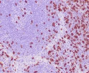 Anti-CD8 alpha antibody [C8/468] used in IHC (Paraffin sections) (IHC-P). GTX34565