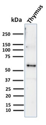 Anti-Cytokeratin 10 antibody [KRT10/844] used in Western Blot (WB). GTX34625