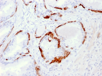 Anti-Cytokeratin 14 antibody [LL002] used in IHC (Paraffin sections) (IHC-P). GTX34631