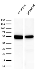 Anti-Cytokeratin 18 antibody [KRT18/1190] used in Western Blot (WB). GTX34637
