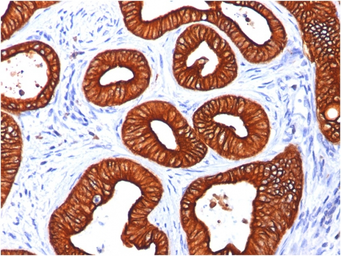 Anti-Cytokeratin 18 antibody [KRT18/834] used in IHC (Paraffin sections) (IHC-P). GTX34642