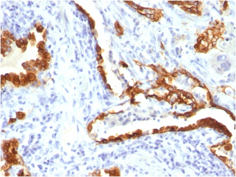 Anti-Cytokeratin 18 antibody [KRT18/834] used in IHC (Paraffin sections) (IHC-P). GTX34642